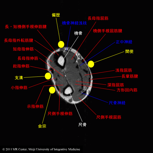 MR経穴 for iPhone - 間使（かんし：PC5）